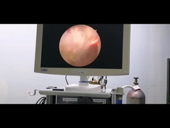 نظام جراحة البلازما RF قطب المسالك البولية لتضخم البروستاتا الحميد